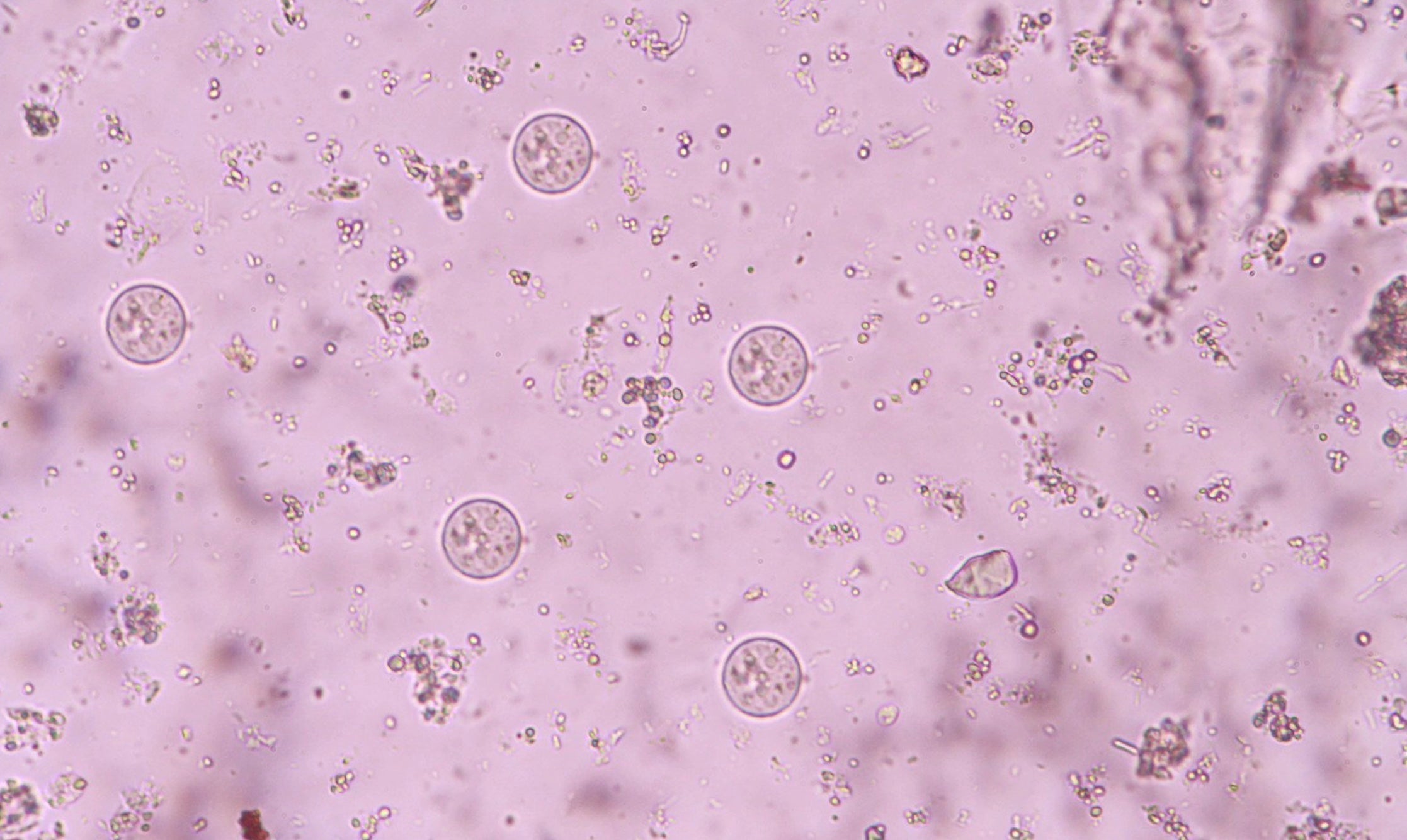Darmparasiten erkennen & vorbeugen: Fakten zu Dientamoeba fragilis