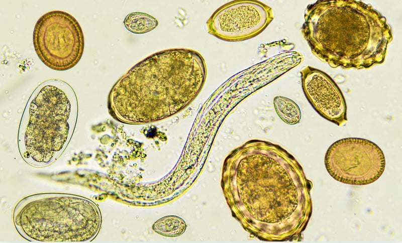 Natürliche Mittel zur unterstützenden Behandlung bei Blastocystis hominis im Darm