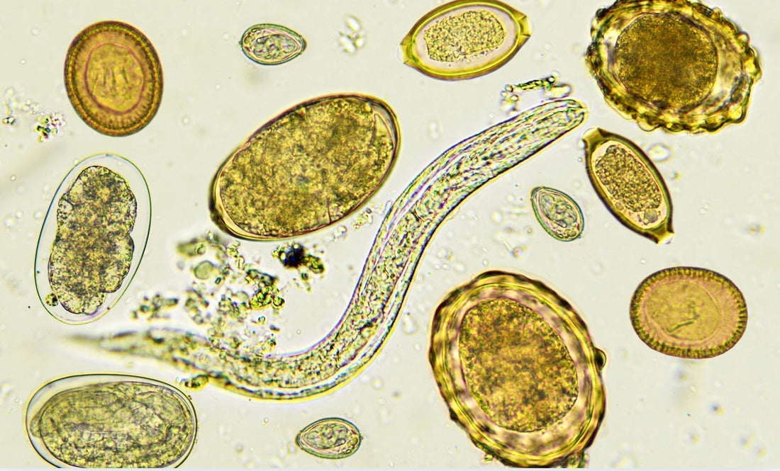 Natürliche Mittel zur unterstützenden Behandlung bei Blastocystis hominis im Darm